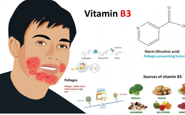 Vitamin B complex (Niacin)